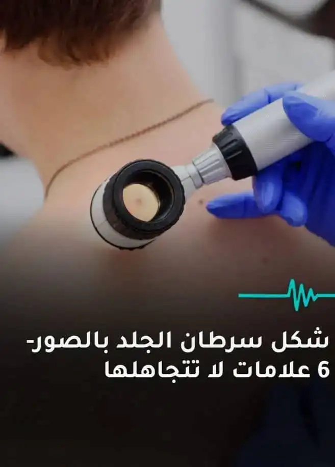 ارشيفية 