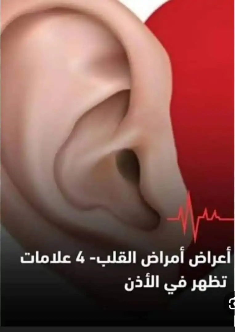 القلب