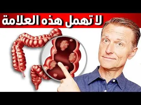 ارشيفية 