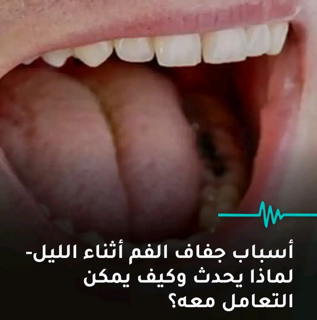 ارشيفية