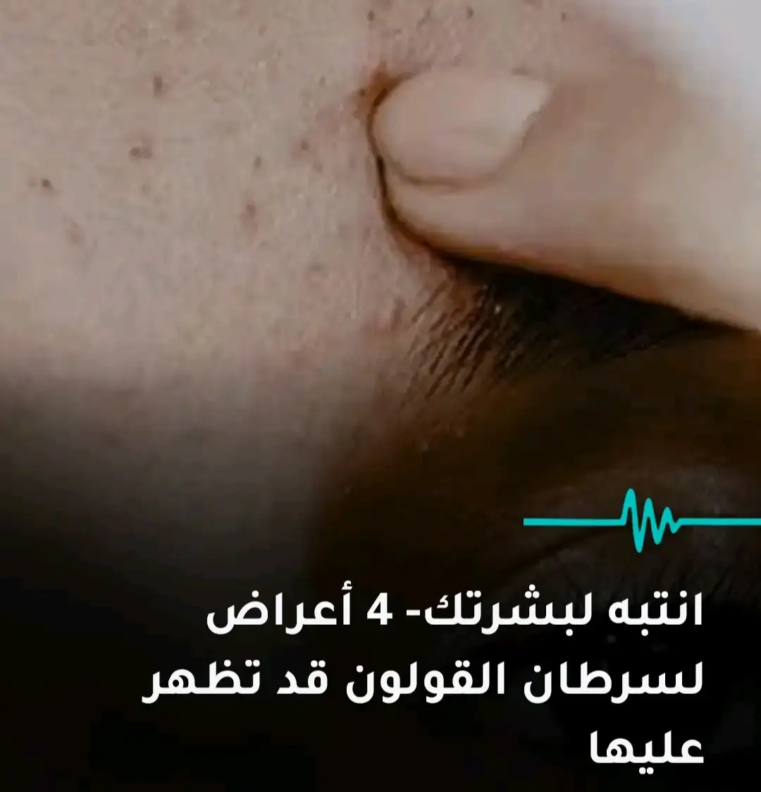  ارشيفية