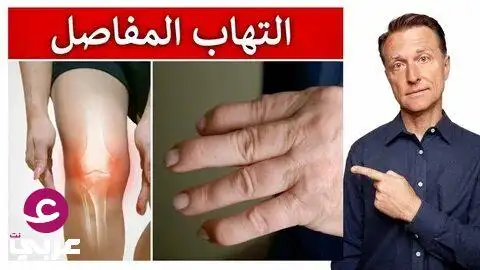  التهاب المفاصل يختفي في 7 أيام من العلاج في المنزل التهاب المفا