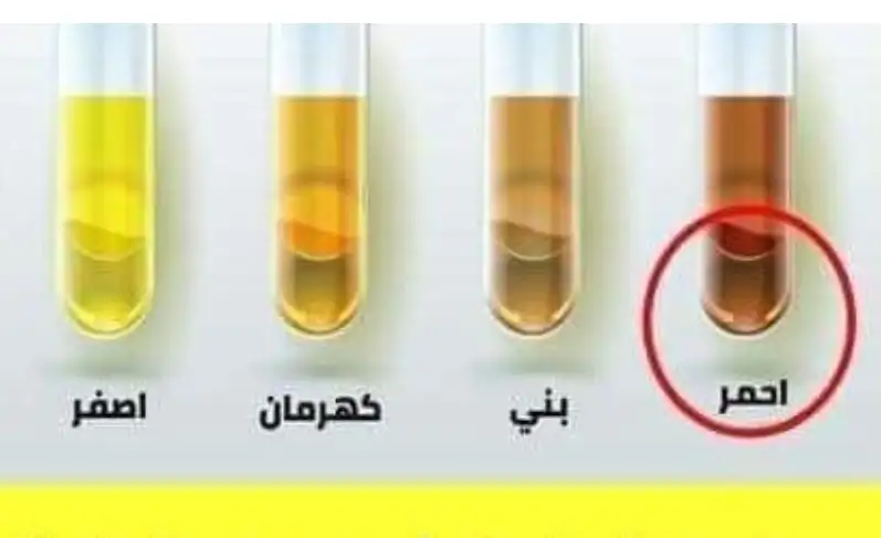 ارشيفية 
