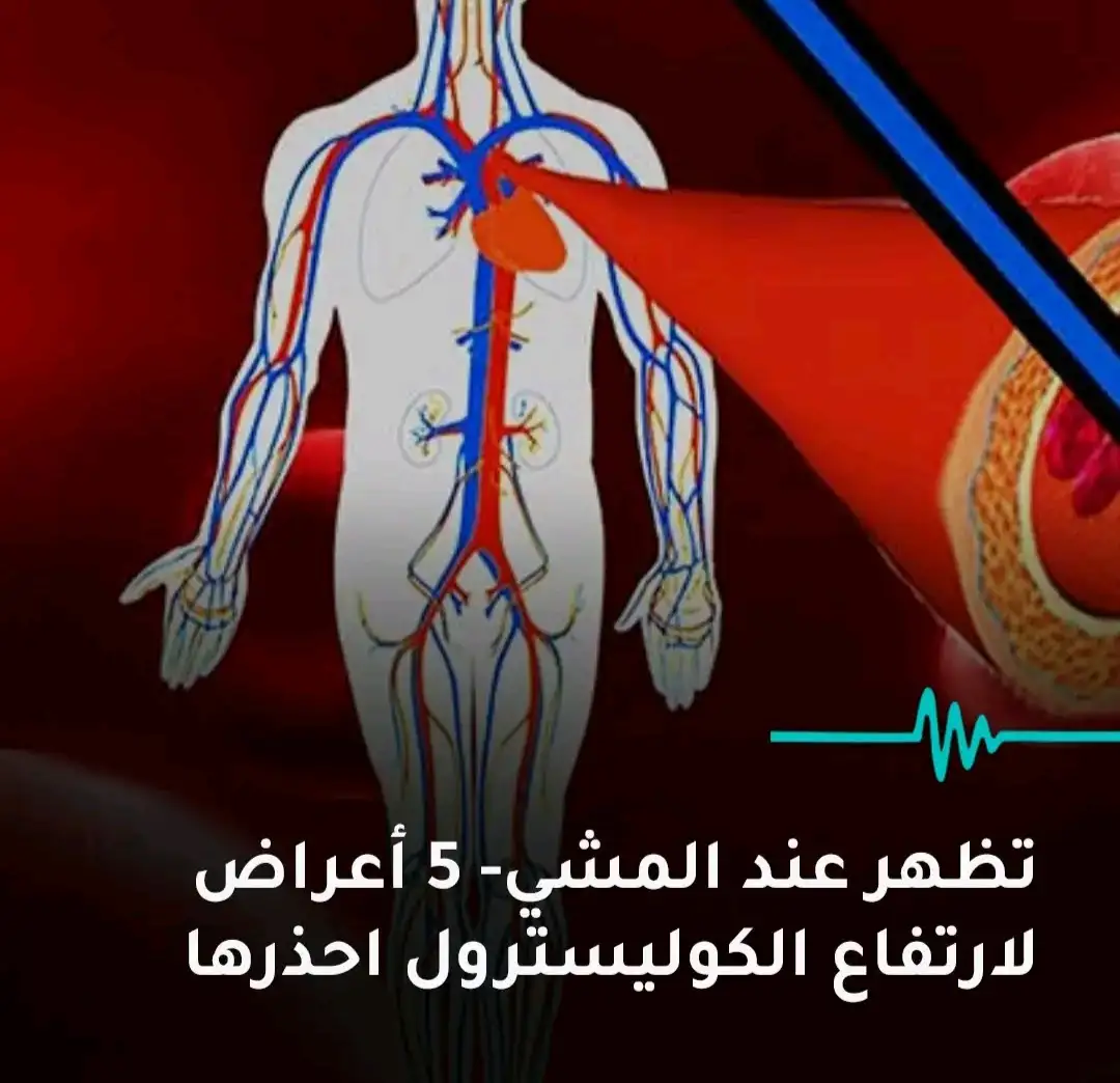  ارشيفية