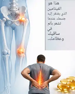 وادعآ للأعشاب المنزلية...هذا الفيتامين الاساسي لتخفيف الام الساق