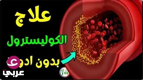 عـ.ـلاج الكوليسـ.ـترول مش لازم يكون بالأدو،ية بس.. 3 أشهر كافية 