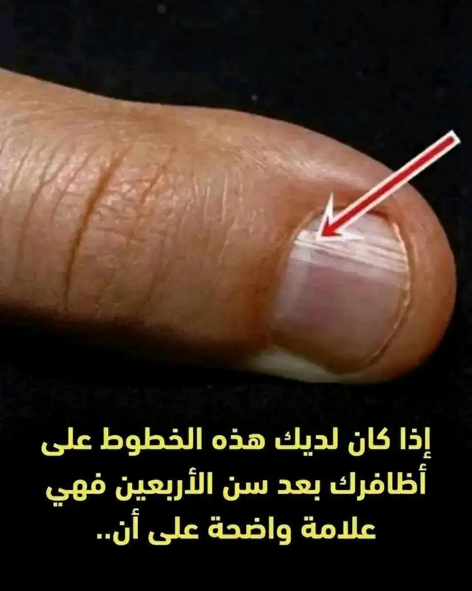 ارشيفية 