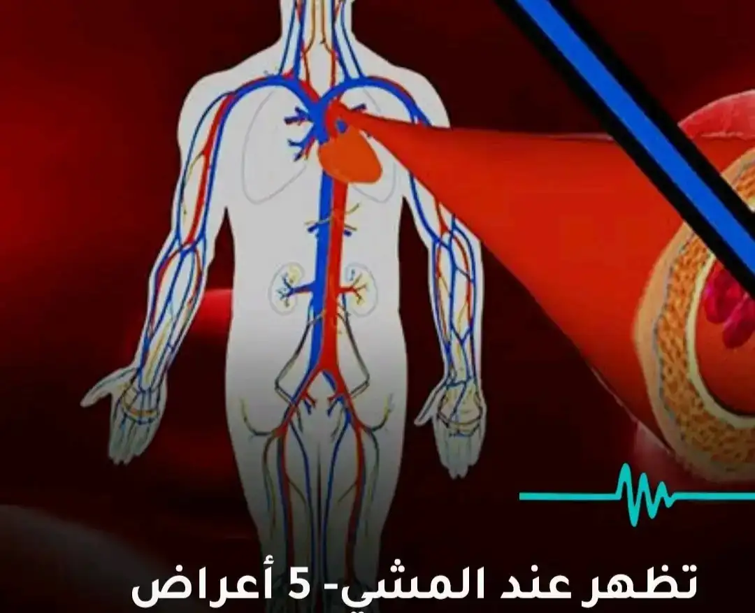 أرشيفة 