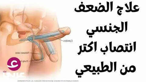 أخيرًا علاج مشاكل الانتصاب والارتخاء أثناء العلاقة الحميمة مع زو