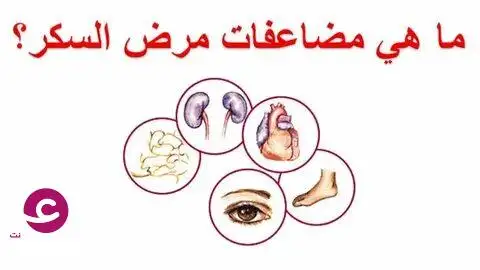 مرض السكري: الأنواع والأعراض المبكرة والأسباب وكيف يحدث؟
