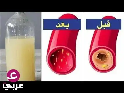 المشروب الذي يعيدك 20 سنة للوراء: ينظف الشرايين ويمنحك طاقة لا ت