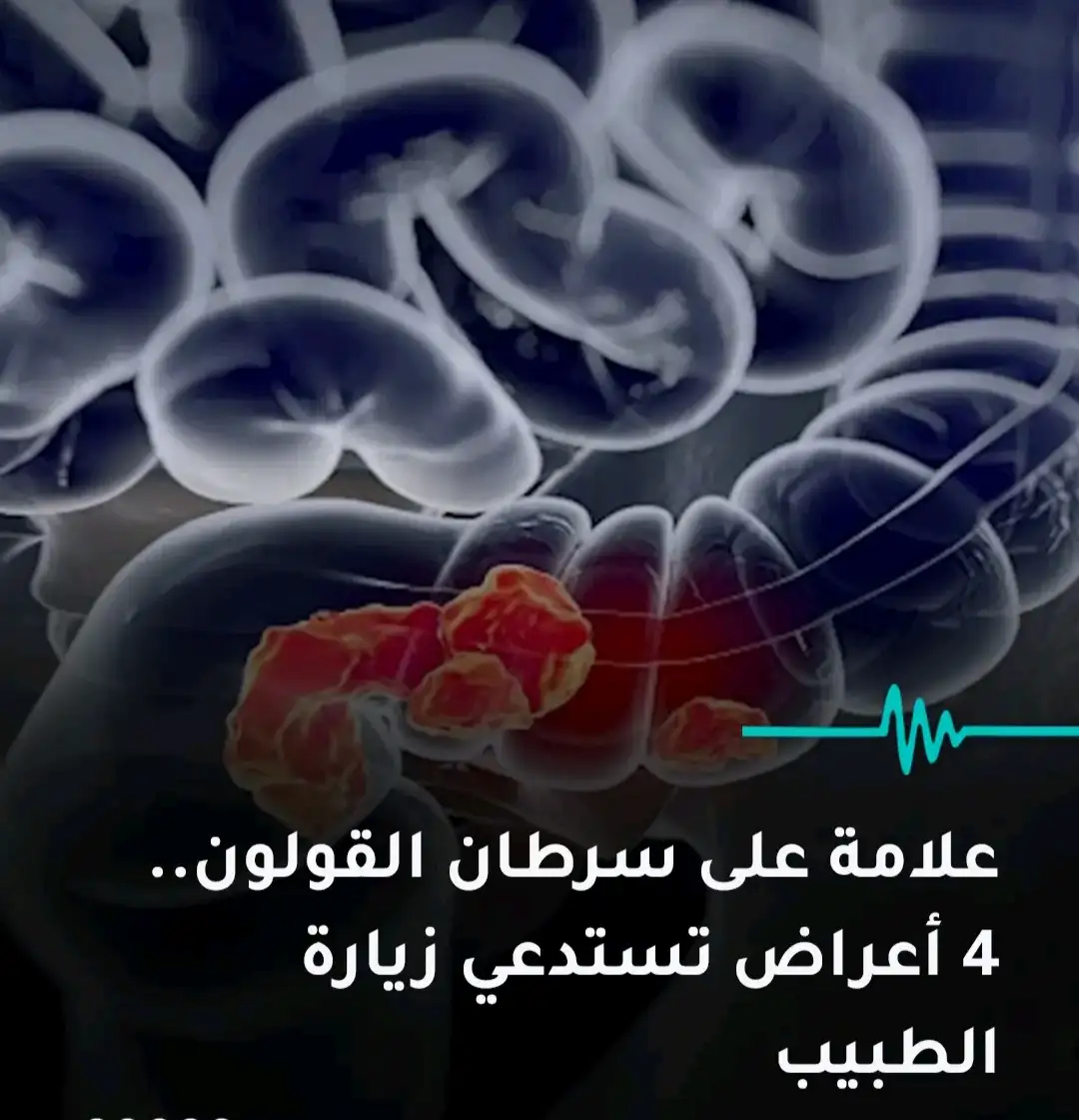ارشيفية 
