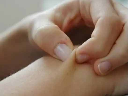 إذا لاحظتها توجه للطبيب فورا.. علامة على الجلد تشير إلى إلاصابة 