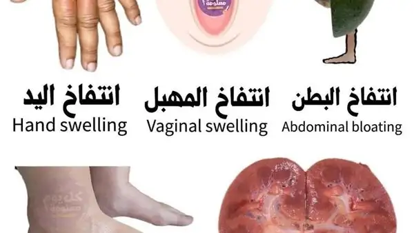 ارشيفية