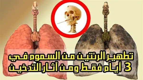 ارشيفية
